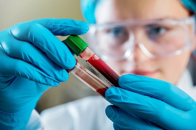 Kompletní krevní test k diagnostice bolesti dolní části zad